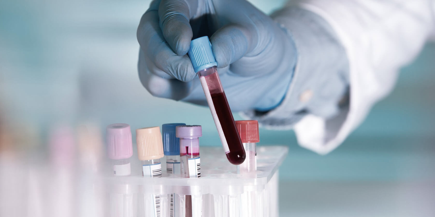 Exosome Diagnostics – Liquid Biopsy Market Update & 2021 Outlook – 25 ...